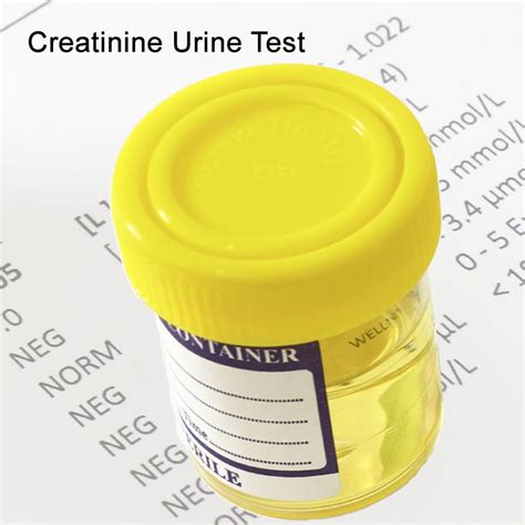 Creatinine Urine Test Blood Tests In London