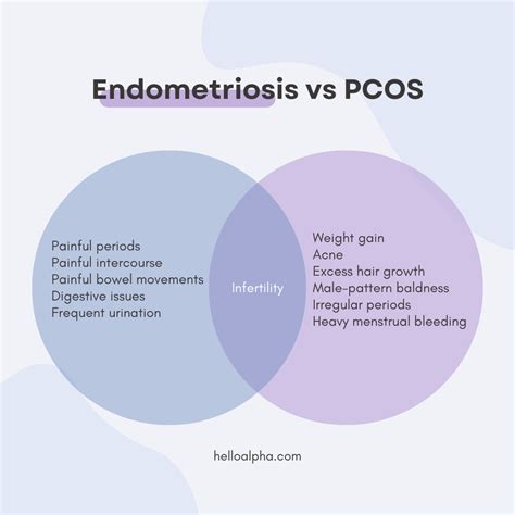 Endometriosis Pcos: Symptoms, Causes, Treatment, 48% Off