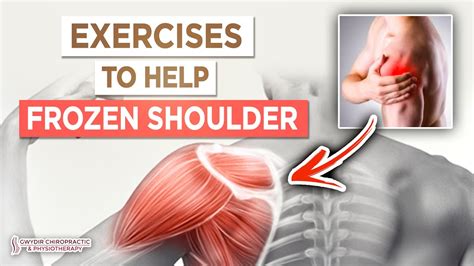 Freezing Shoulder Exercises: Relieve Pain Fast