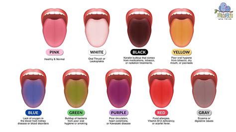 Healthy Tongue Color