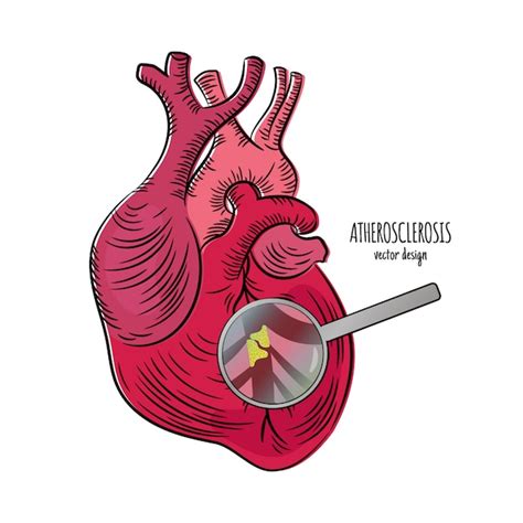 Heart Diesease Drawing