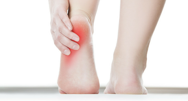 How Does Yale Podiatry Ansonia Treat Heel Pain?