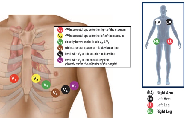 How To Place Ecg Leads Correctly? Stepbystep