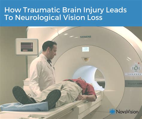 How Traumatic Brain Injury Leads To Neurological Vision Loss Novavision