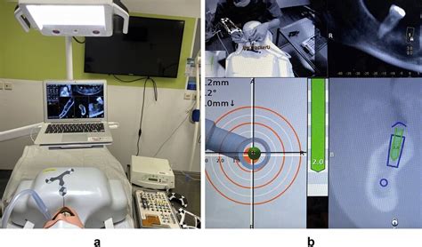 Navigation Surgery A Overview Of Navigation System B Operation