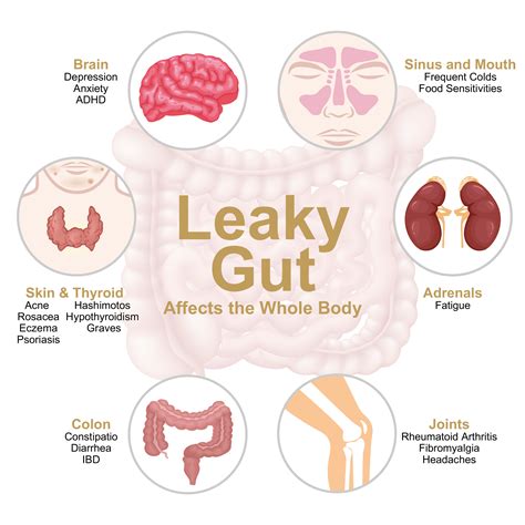 What Affects Gut Health Check? Fix Digestion