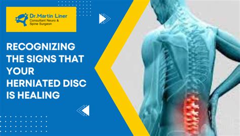 What Are Signs Herniated Disc Is Healing?