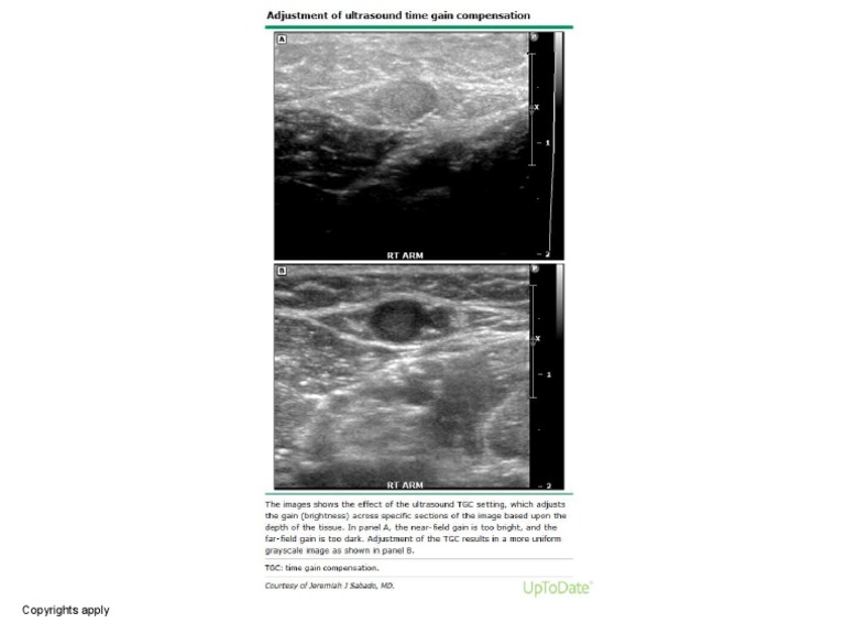 What Is Time Gain Compensation Animal Ultrasound Association