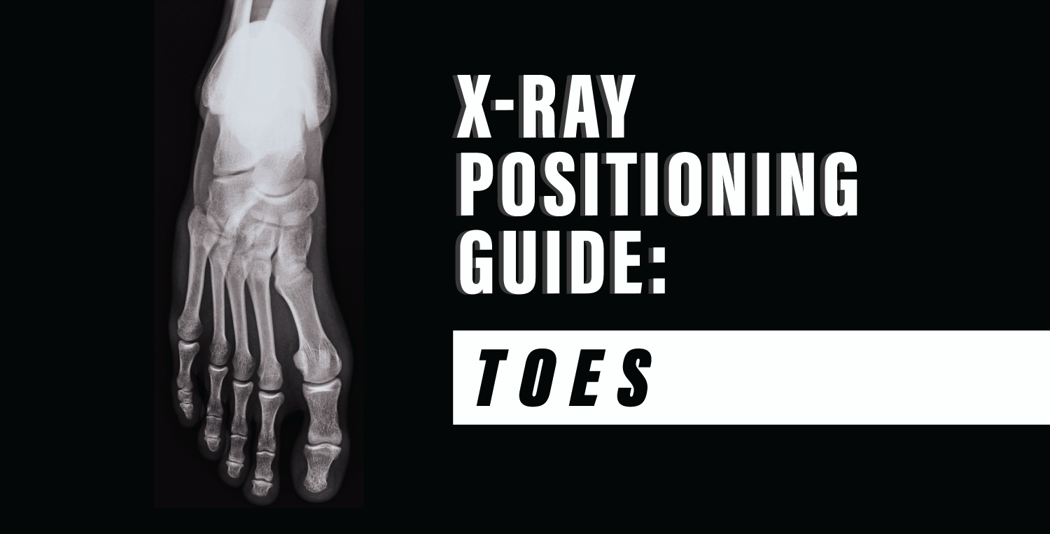 X Ray Positioning Guide Toes Medical Professionals