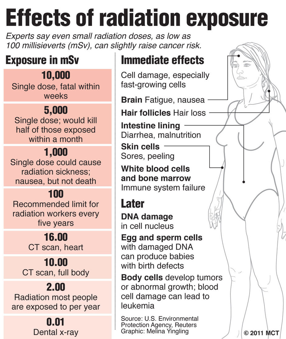 X Ray Radiation Exposure Limits At Preston Rivera Blog